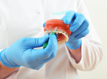 Pot beneficia adulții de rezultate satisfăcătoare de la un aparat dentar?